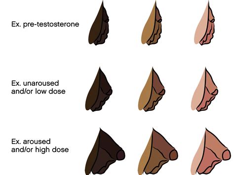 Bottom Growth and Genital Changes on Testosterone。